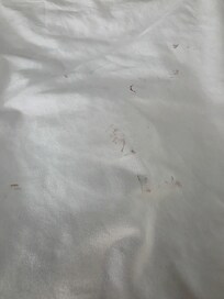 Bed sheets dirty(blood?)