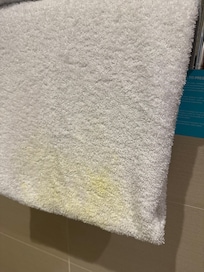 Flecken auf Handtüchern