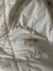 Dried Blood on the underside of the bedspread leading me to believe they knew it was there.