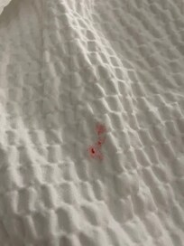 Mystery strawberry crust in blankets