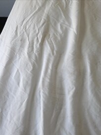 Mole on every layer of sheets