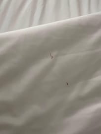 Blood on sheets