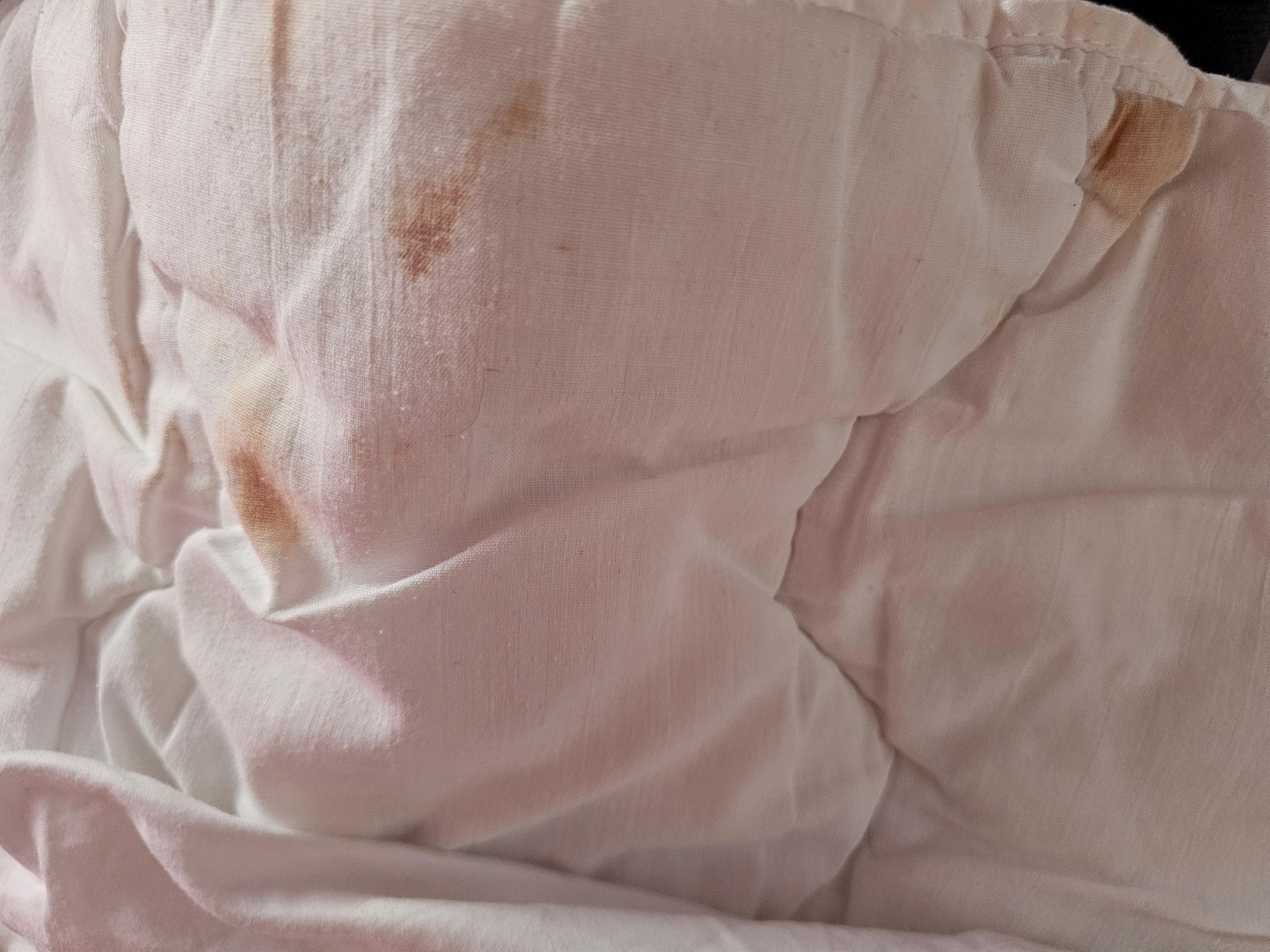 Stained sheets!