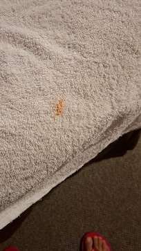 Toalla manchada de sangre