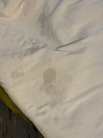 Stains on sheets.