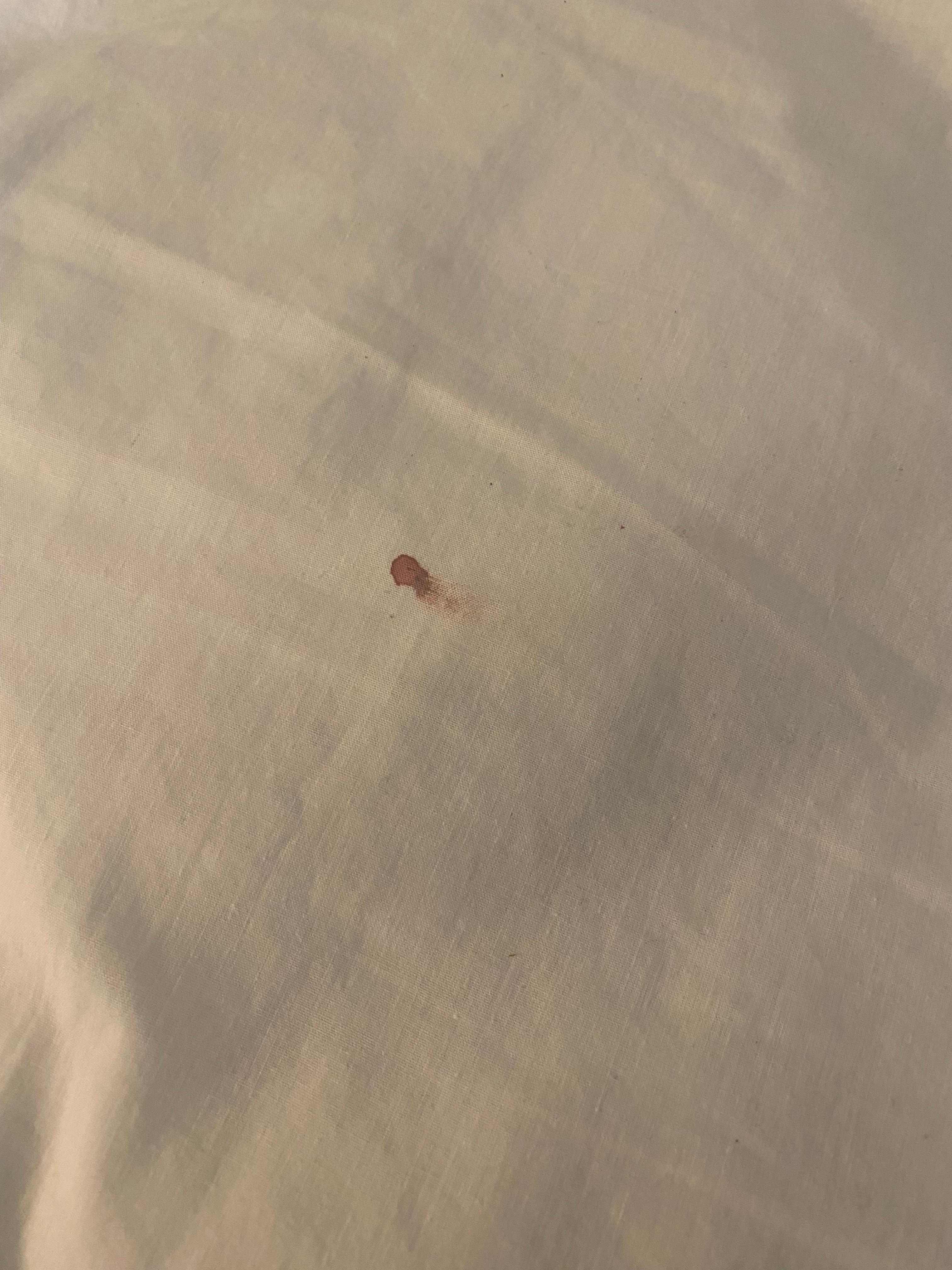 Bedbugs in rm 132 