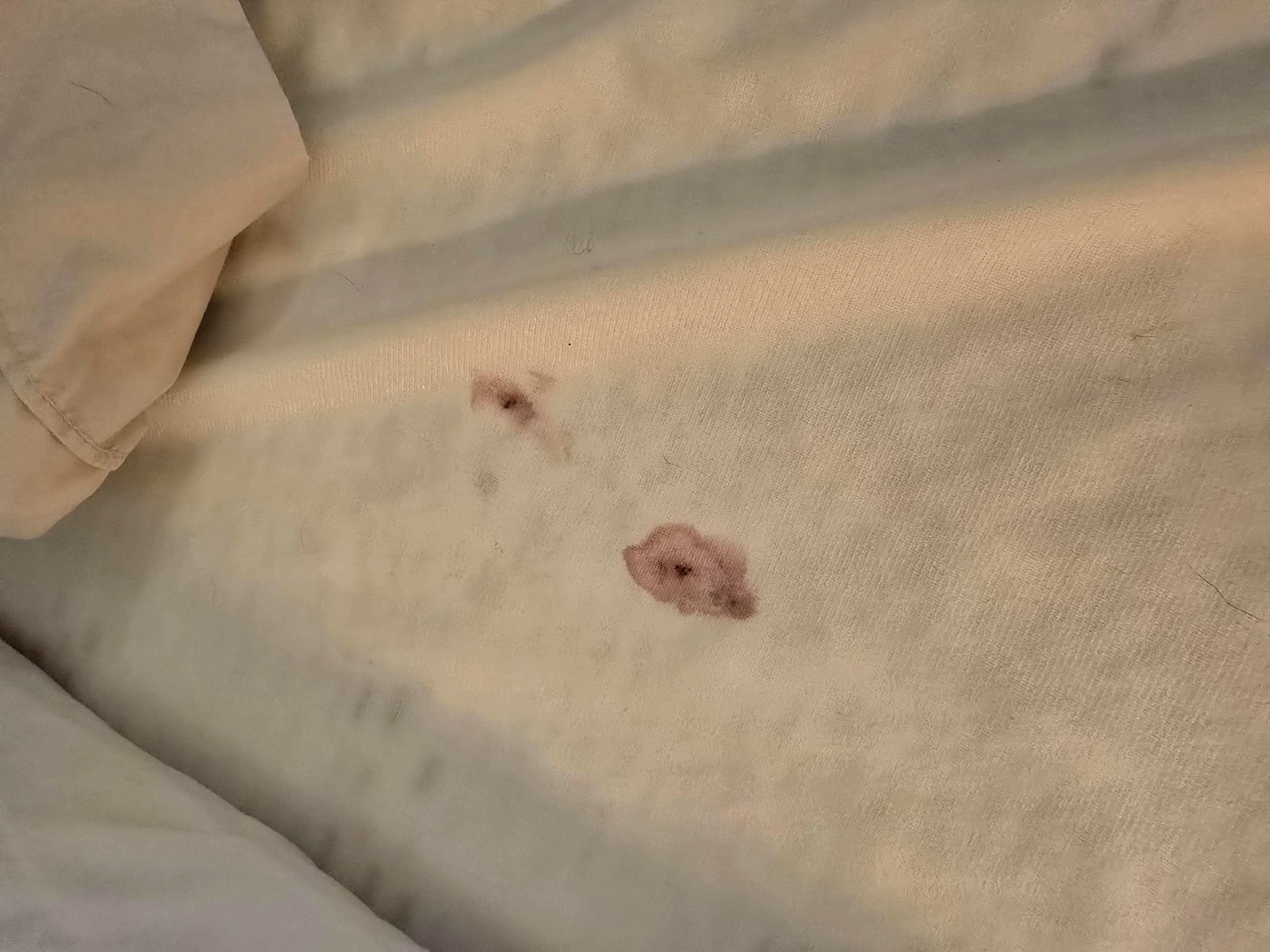 Under the sheets! Gross!!