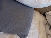 weird yellow ish white stain on the pillow