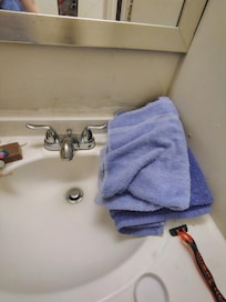 It was dirty all over the bathroom sink and cigarette burns