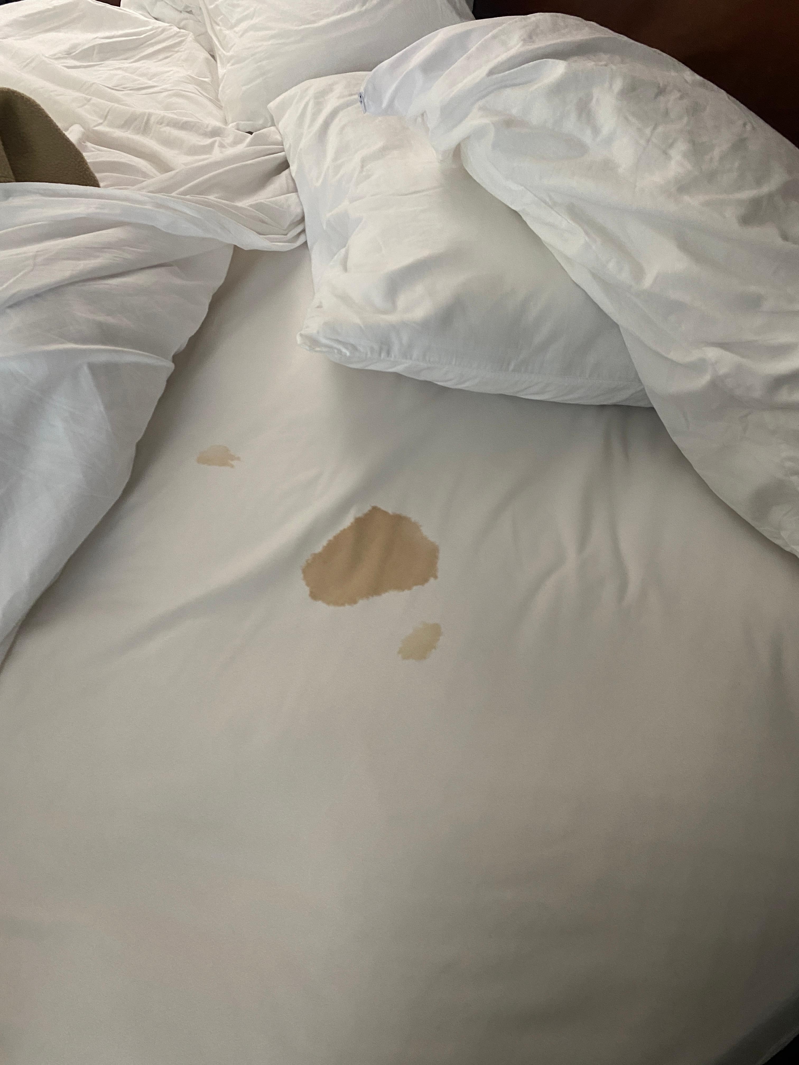 Blood stains show thru sheets.
