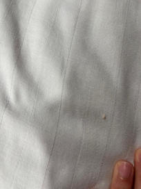 Bed bug egg
