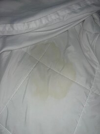Yellow stain