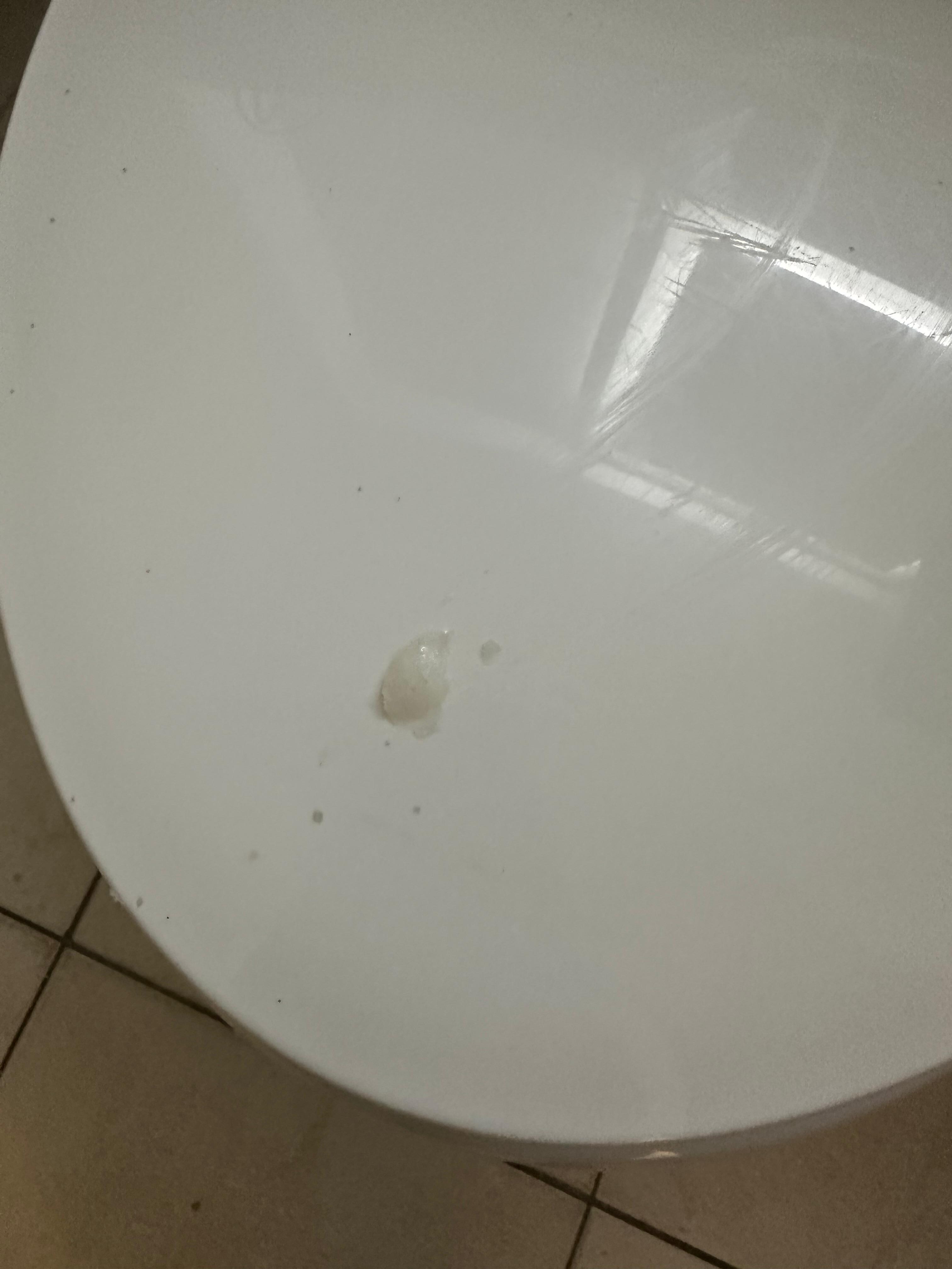 This is my toilet that has some big glob of something on it when I just got there that’s all over the toilet, but I’m only allowed to put seven photos up