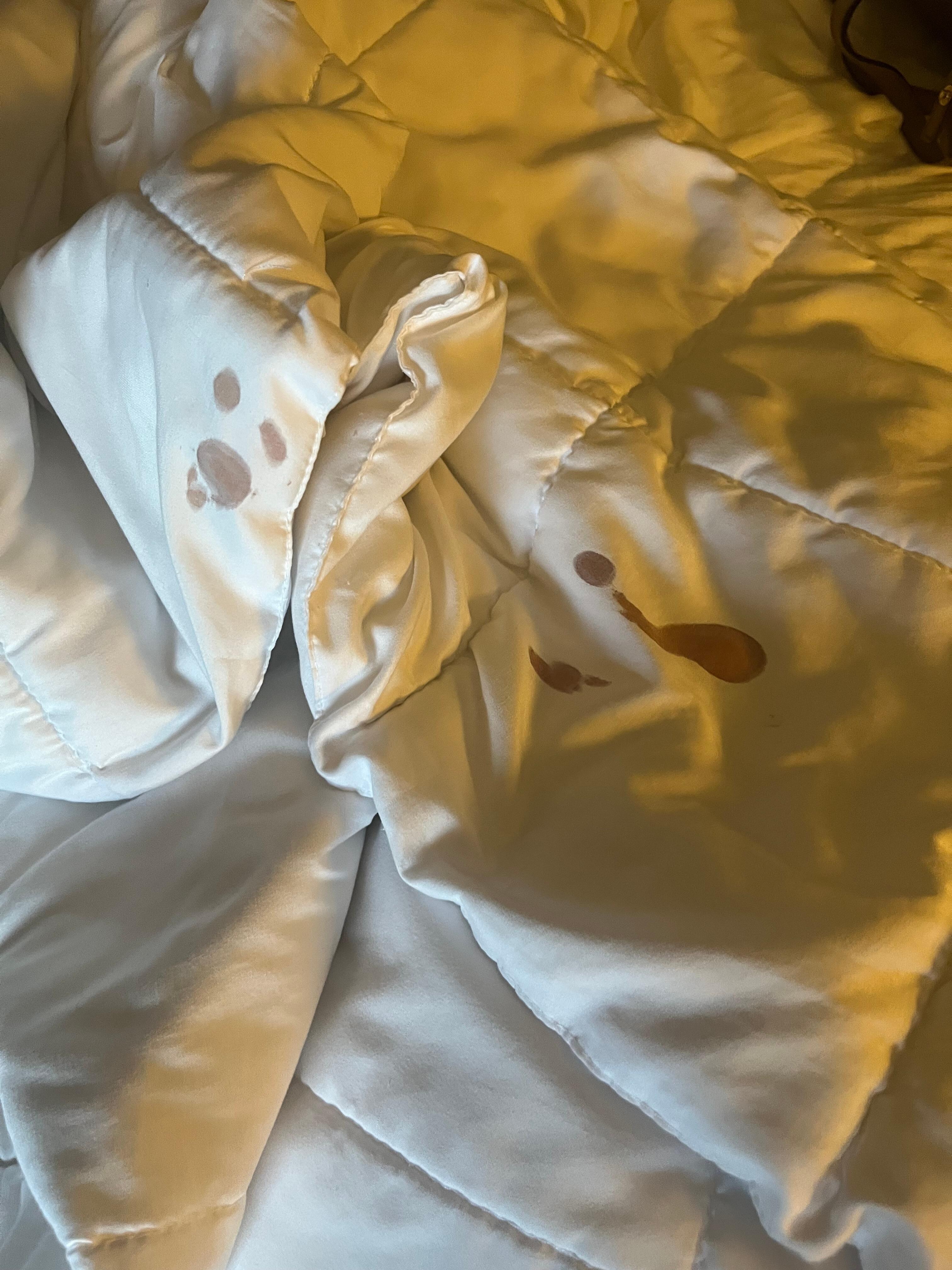 This is a picture of the bloody comforter. Very unsanitary 