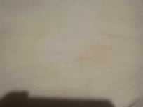 Brown stain on bed sheets