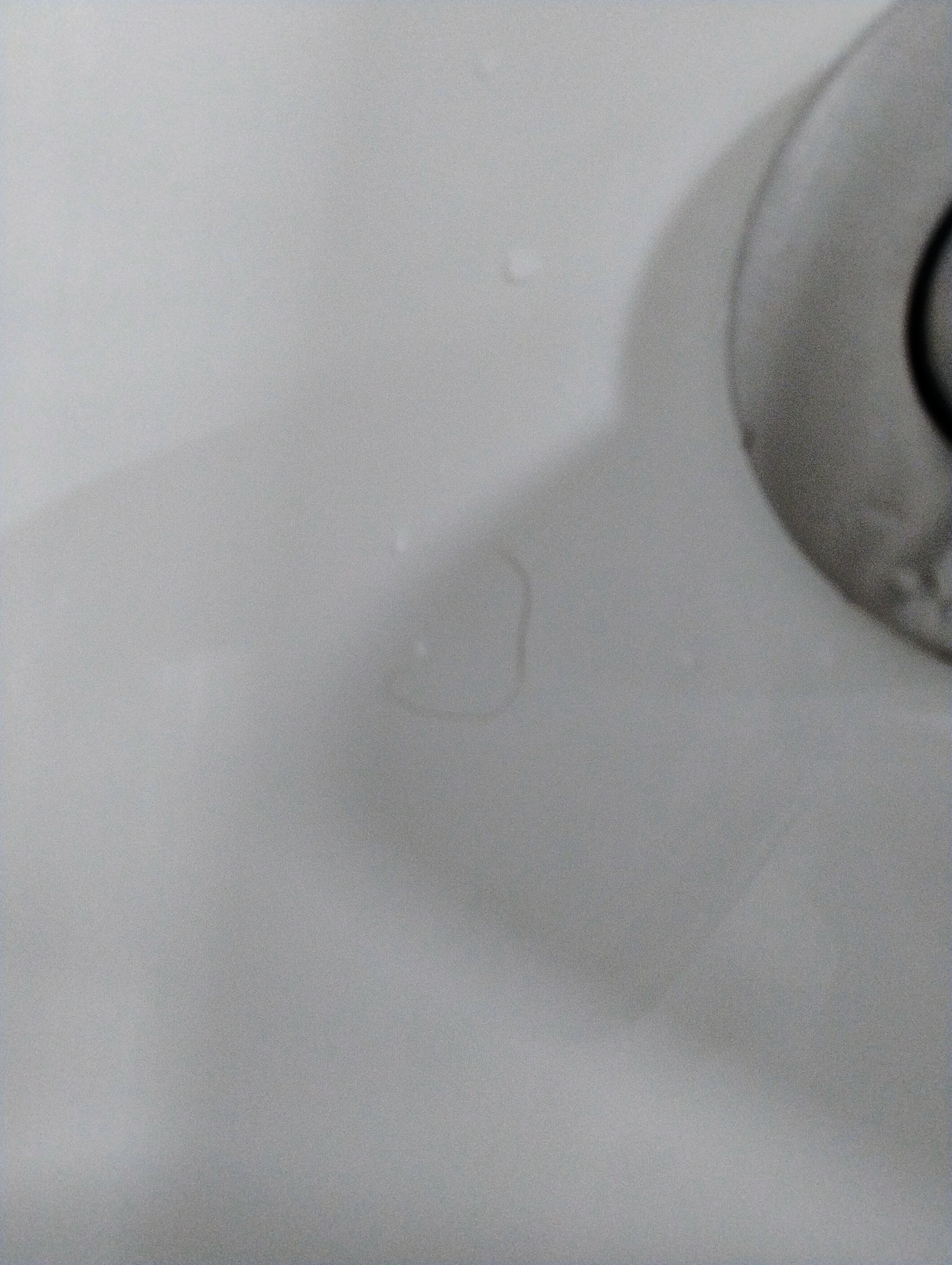 Hair