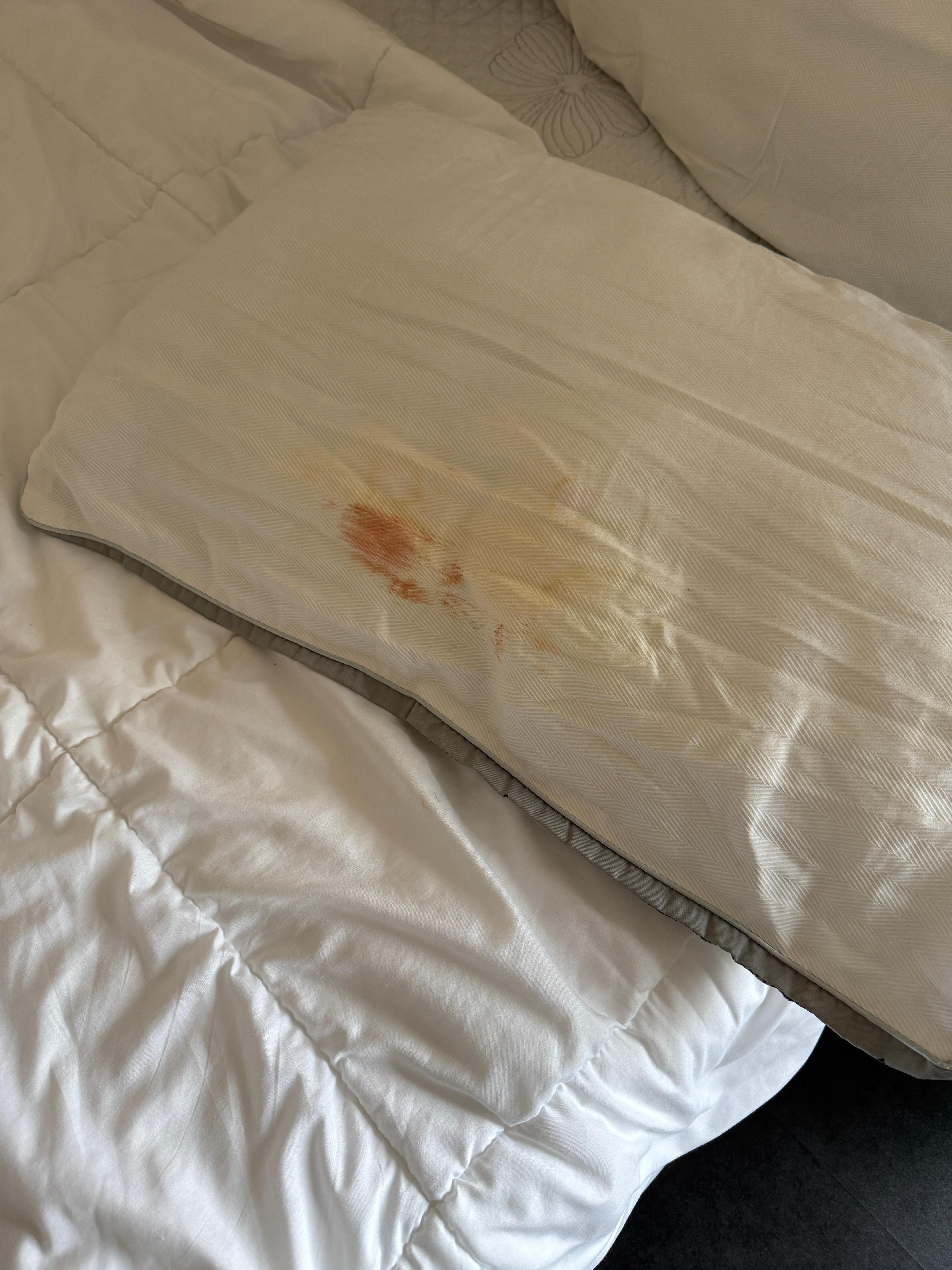 Blood on pillow
