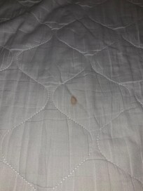 Blood on bedding