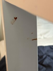Dried blood