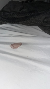 Bloody sheets