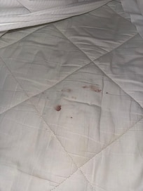 The blood stain on the bed