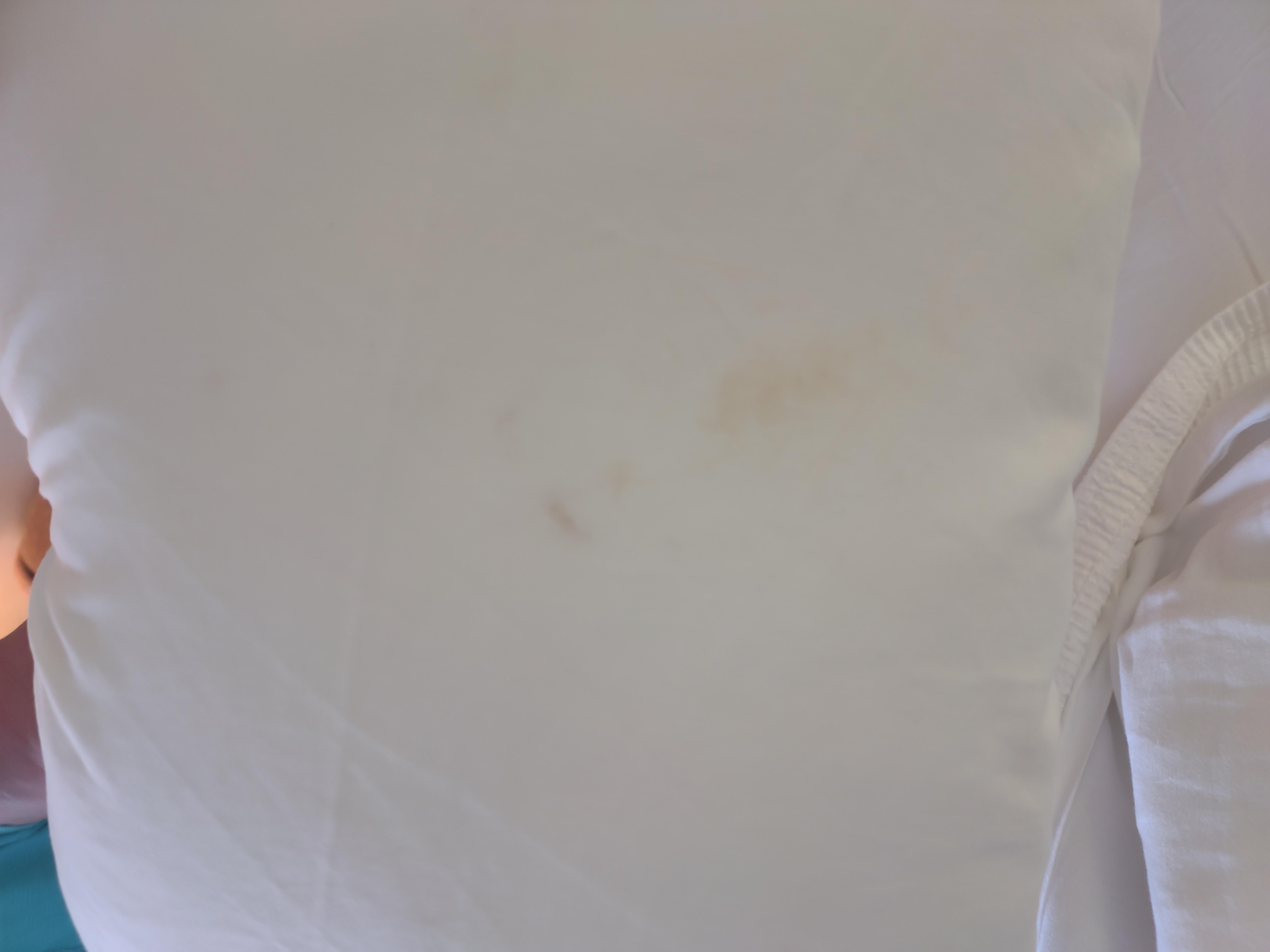 Stains on the sheets.