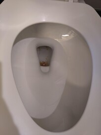 Dirty toilet.