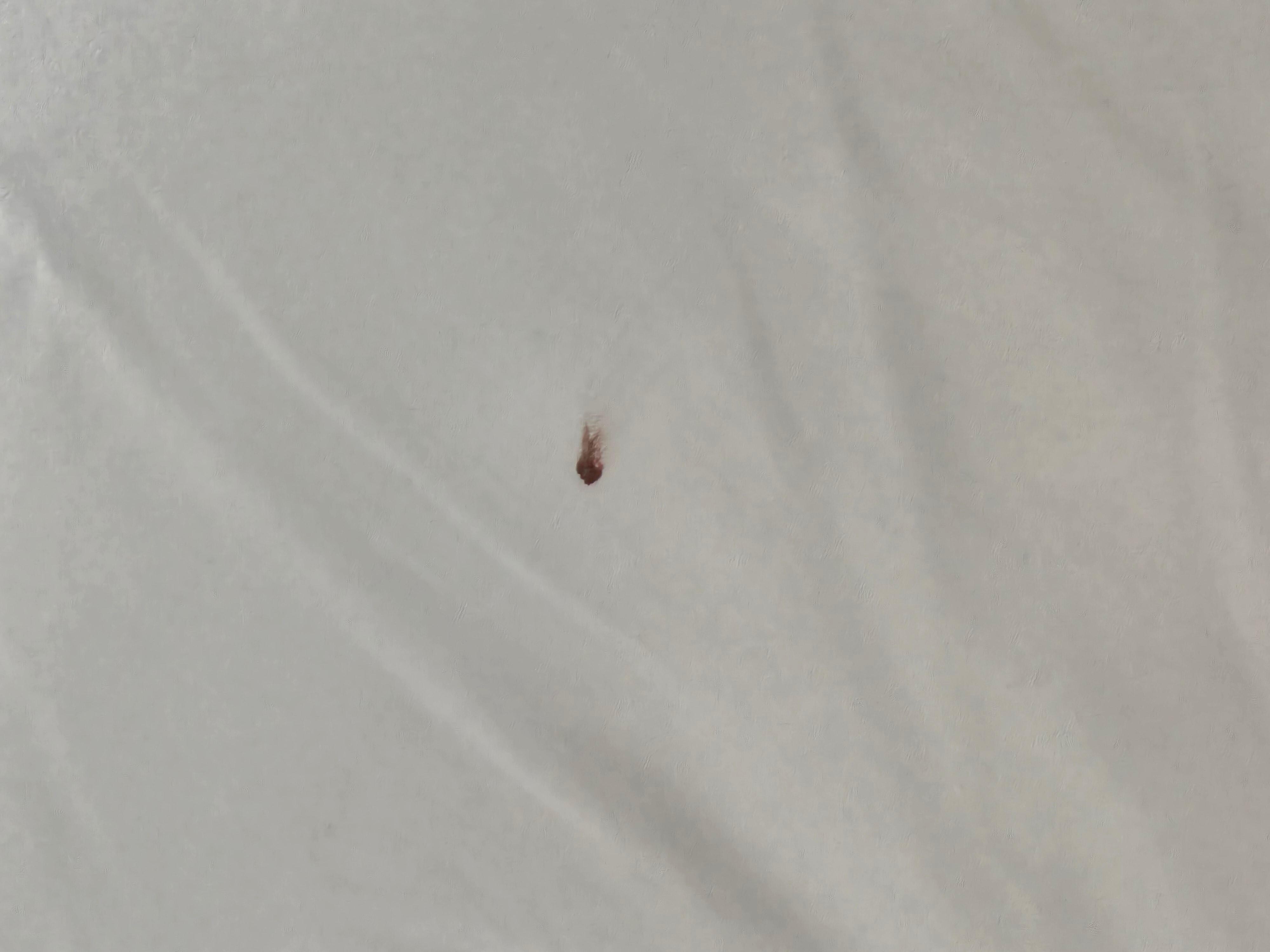 Tick #2