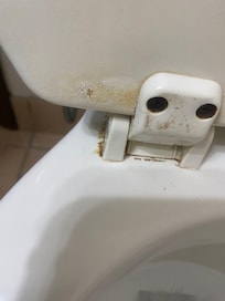 Filth on the toilet seat