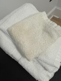 Discolored towels