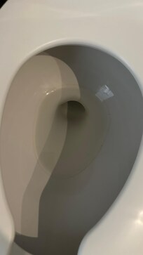 WC sucio