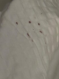 Blood stains on comforter