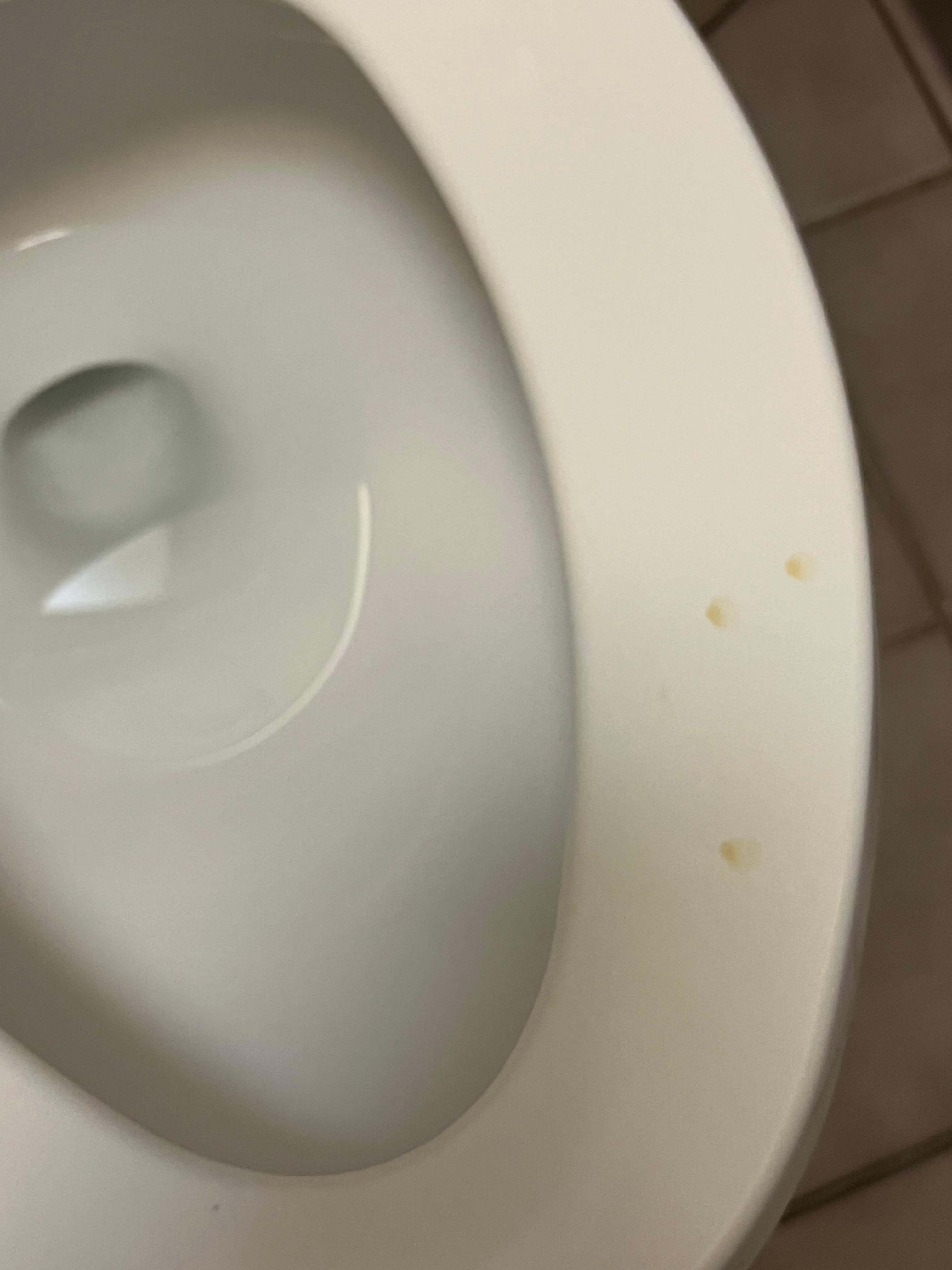 Dried pee