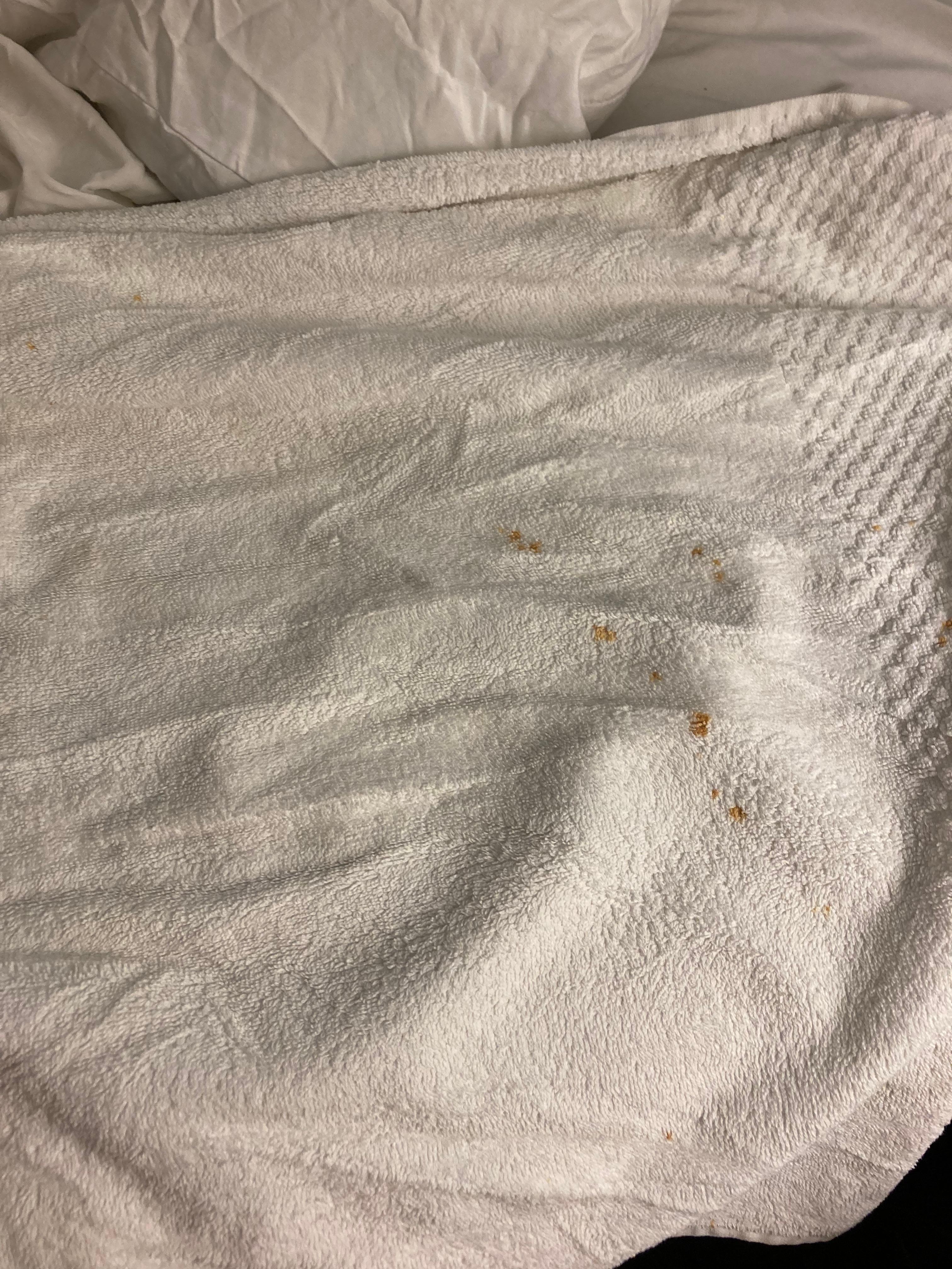 Stained towels