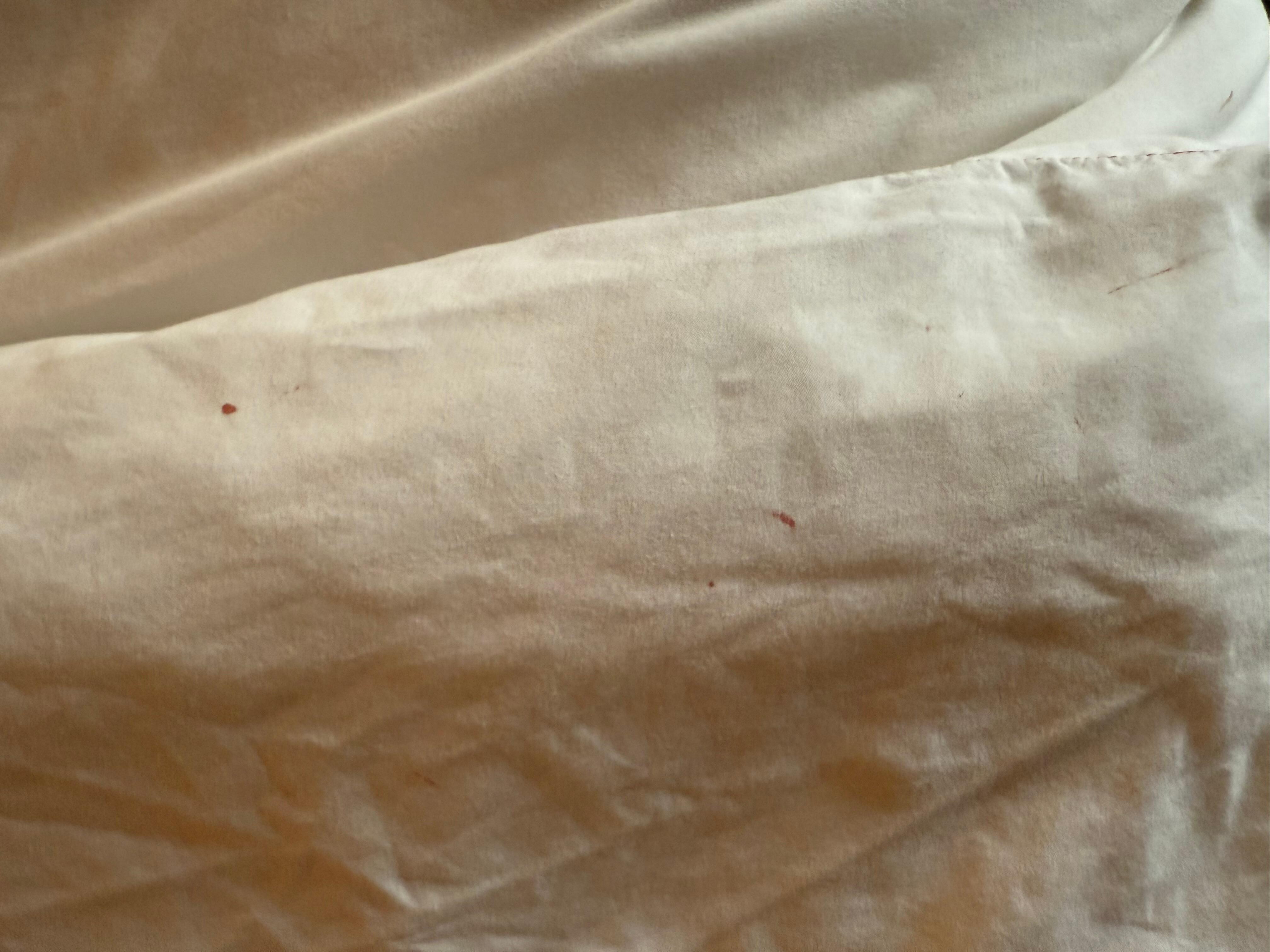 Stains on all bedsheets