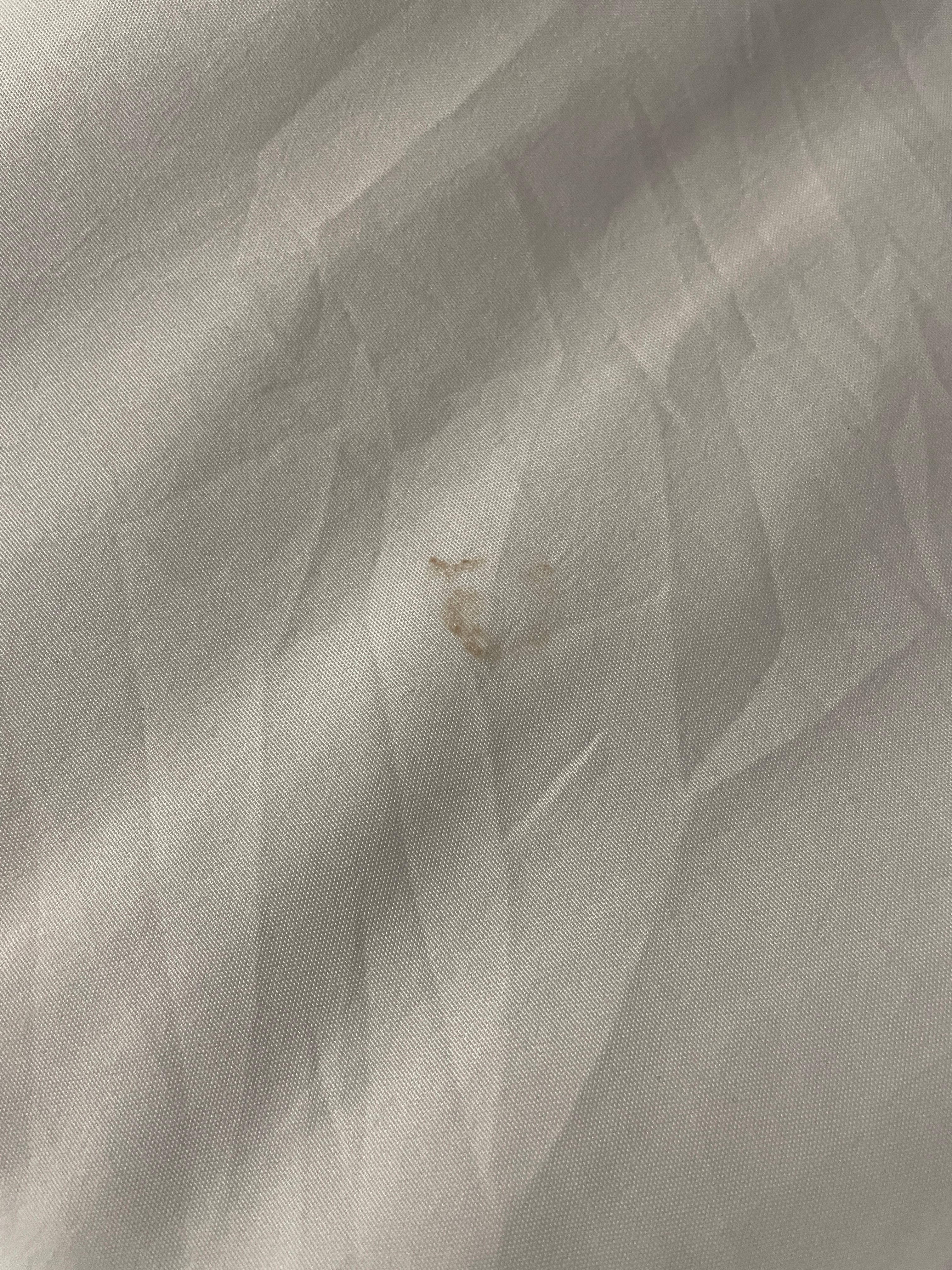 Looks like a blood stain