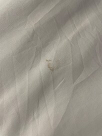 Looks like a blood stain