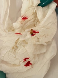 Bed Bug found in room