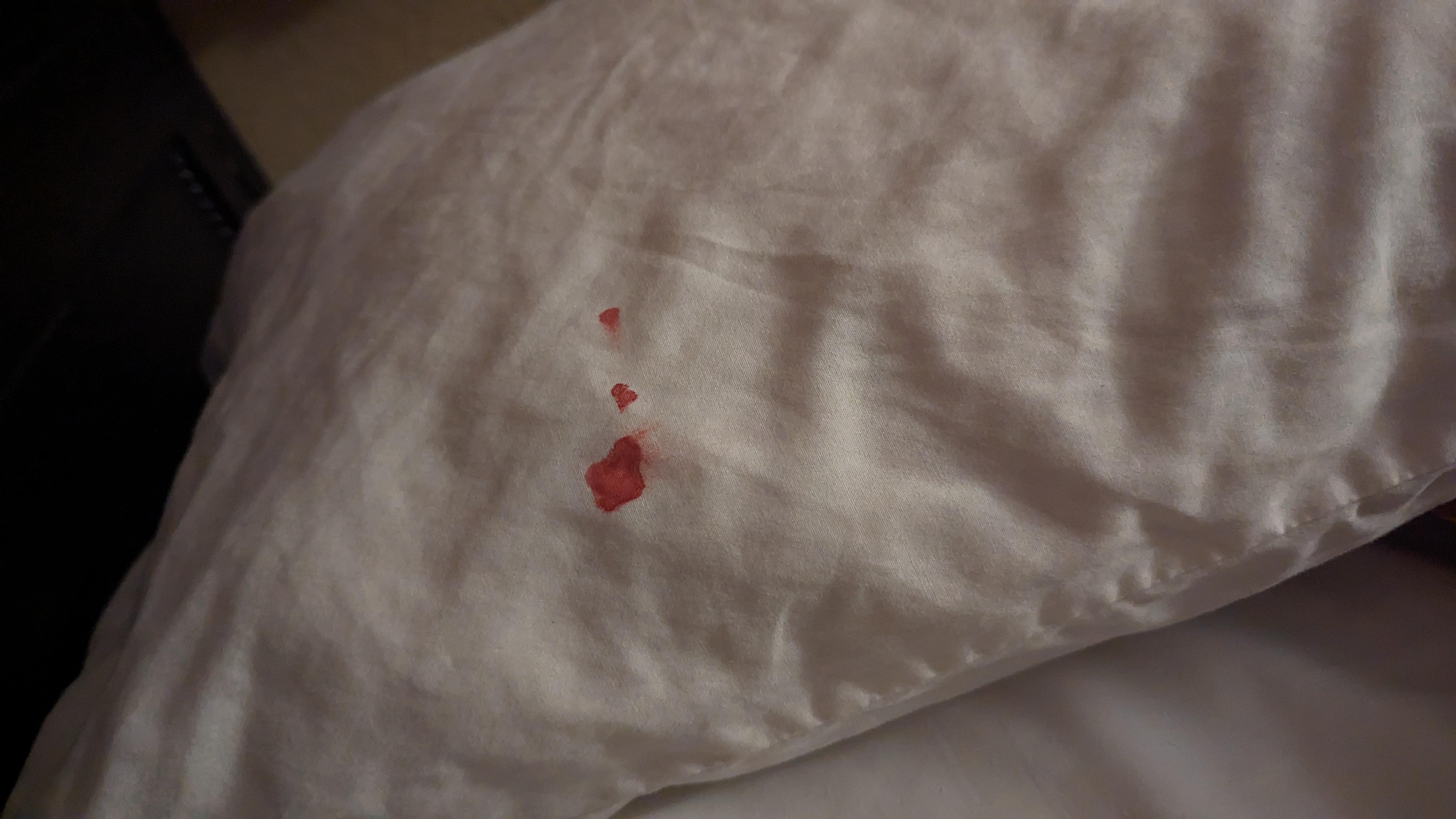Bloody pillowcase