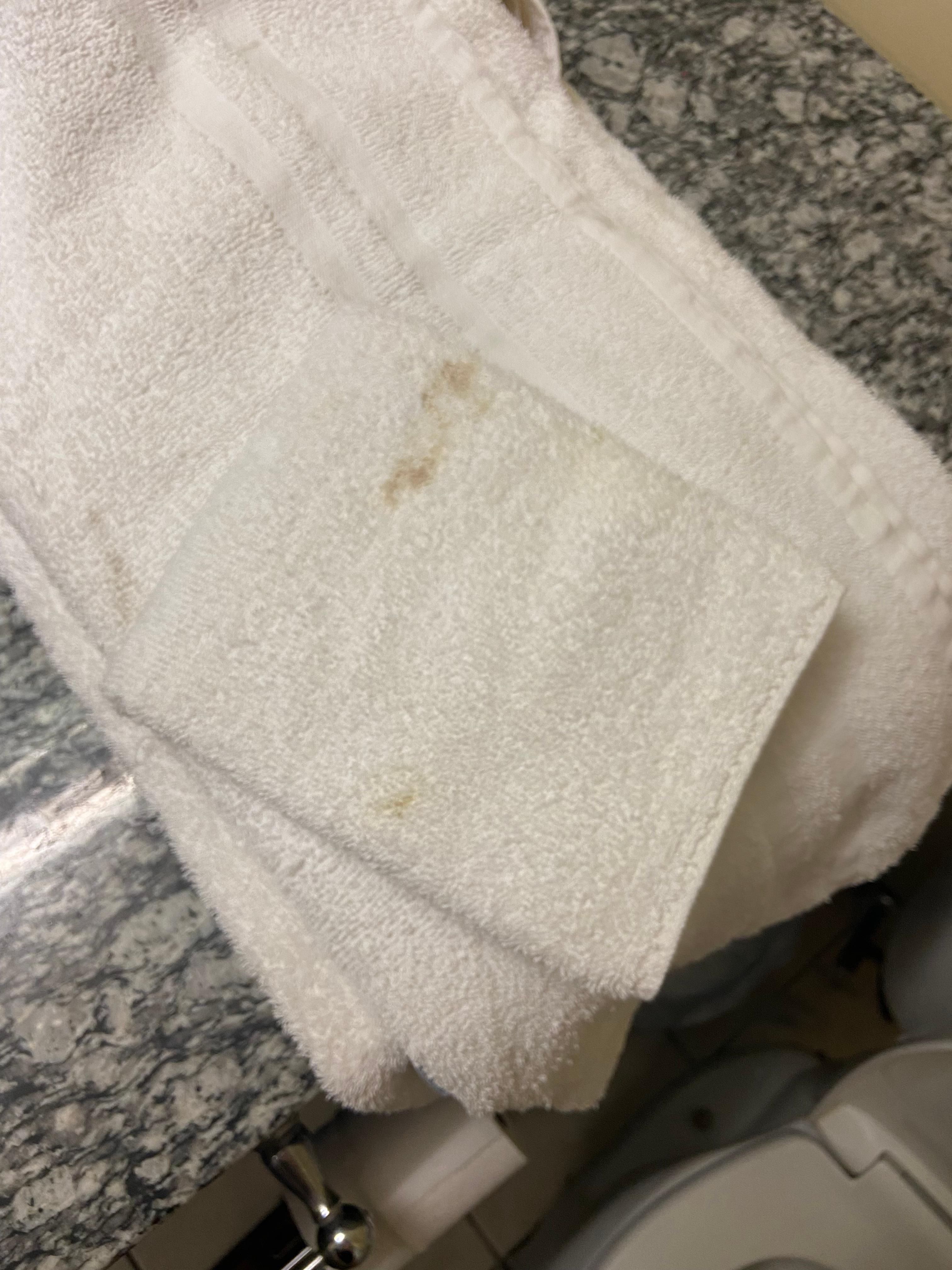 Dirty towels and face cloths. Others were black. 