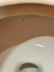 Dirty toilet