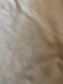Marks on bedsheets