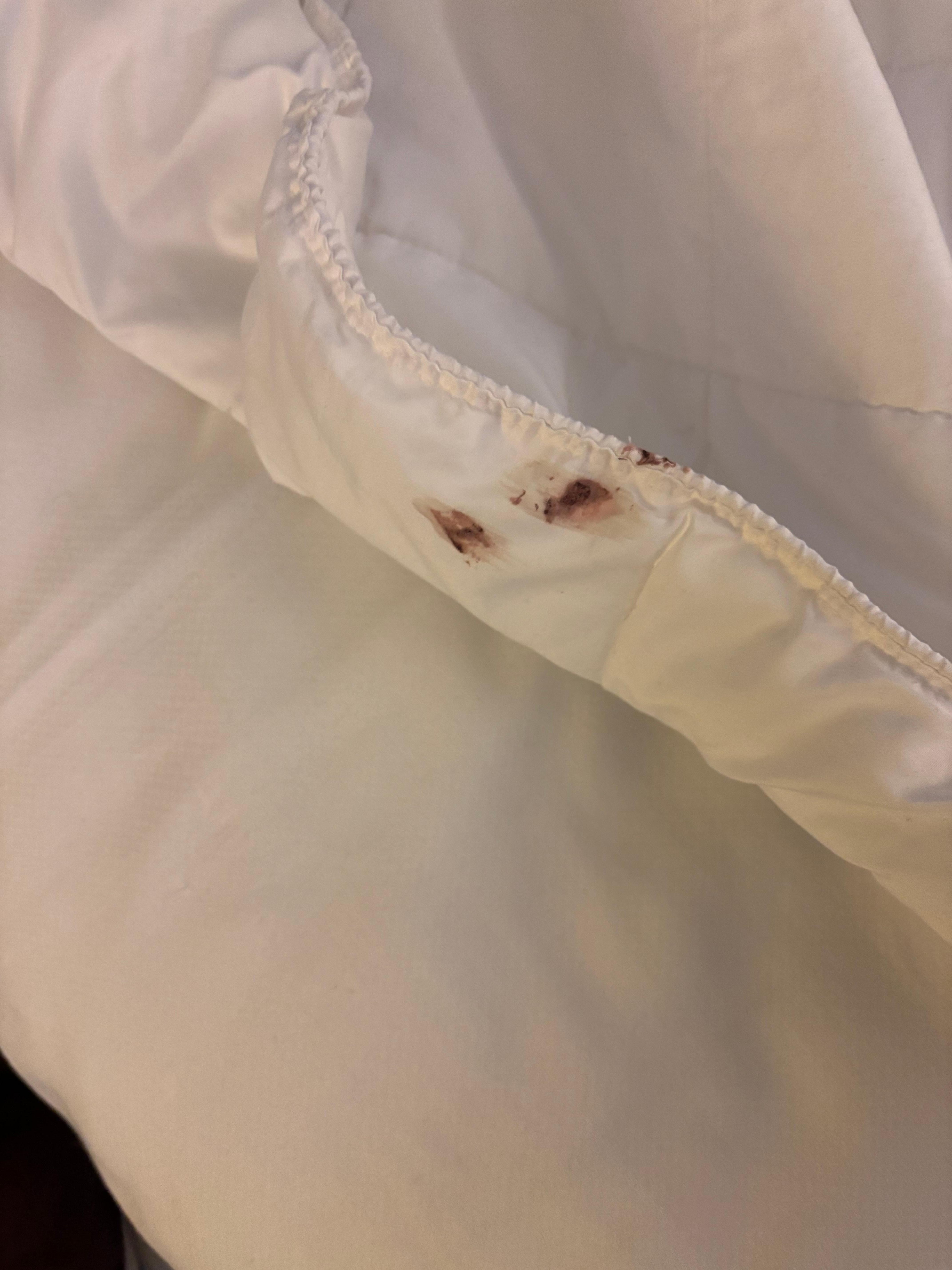 Found this stain on our comforter.. unacceptable. Told front desk and gave us a voucher for breakfast which i refused. This is unacceptable. They told me to email this photo to their reservations email. 🤷‍♀️