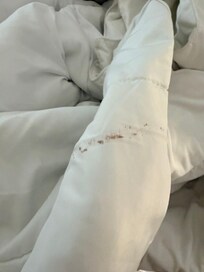 These were the sheets stained and full of hair.