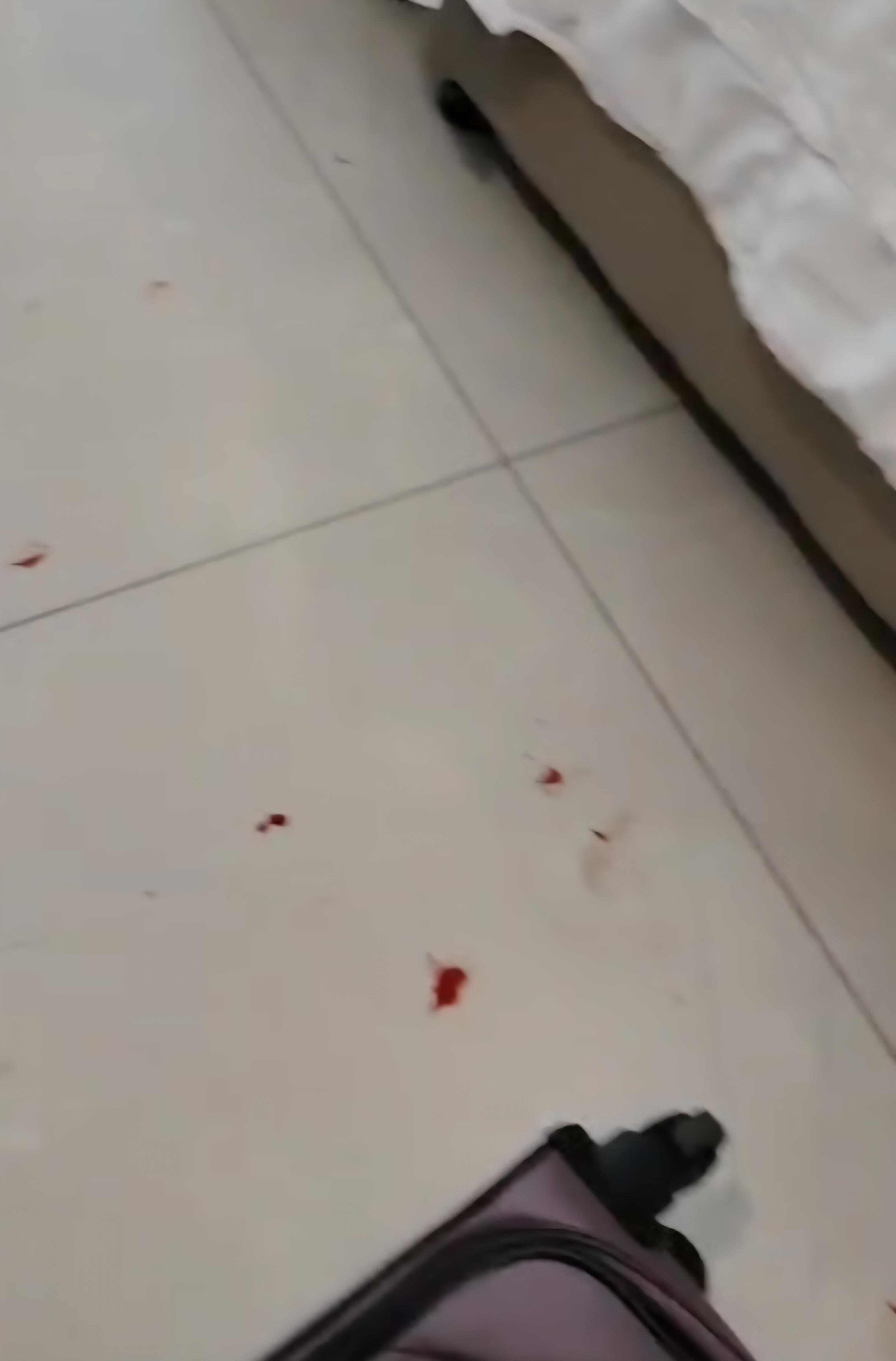 Blood on floor from my wounds
