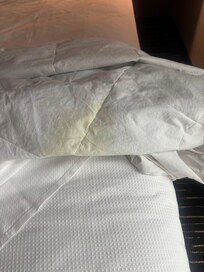 This is a picture of the soiled duvet. Disgusting!