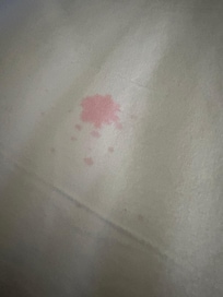 Stains on sheets