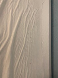 Stains in bedroom.