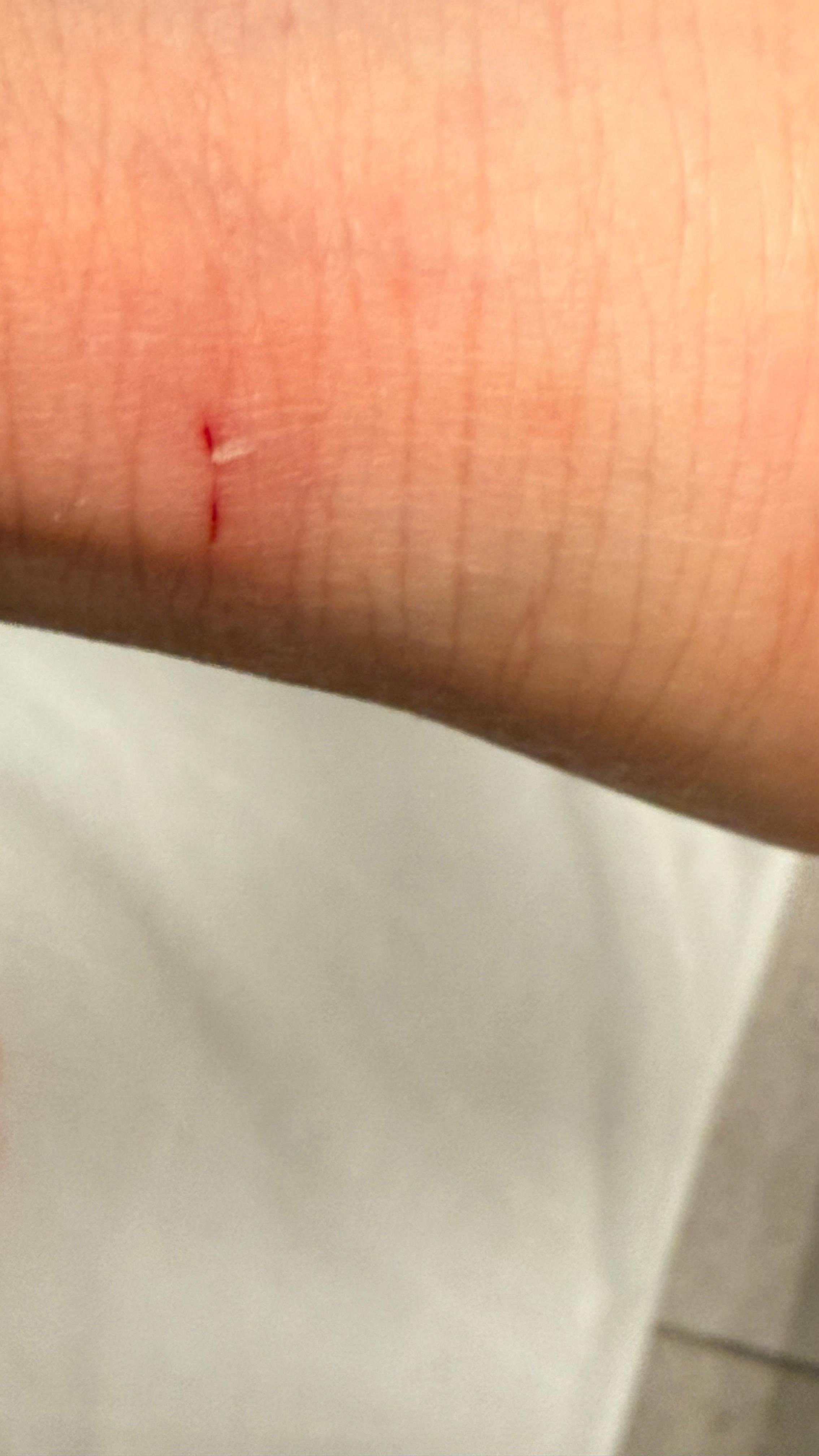 腳跟被淋浴間門刮傷