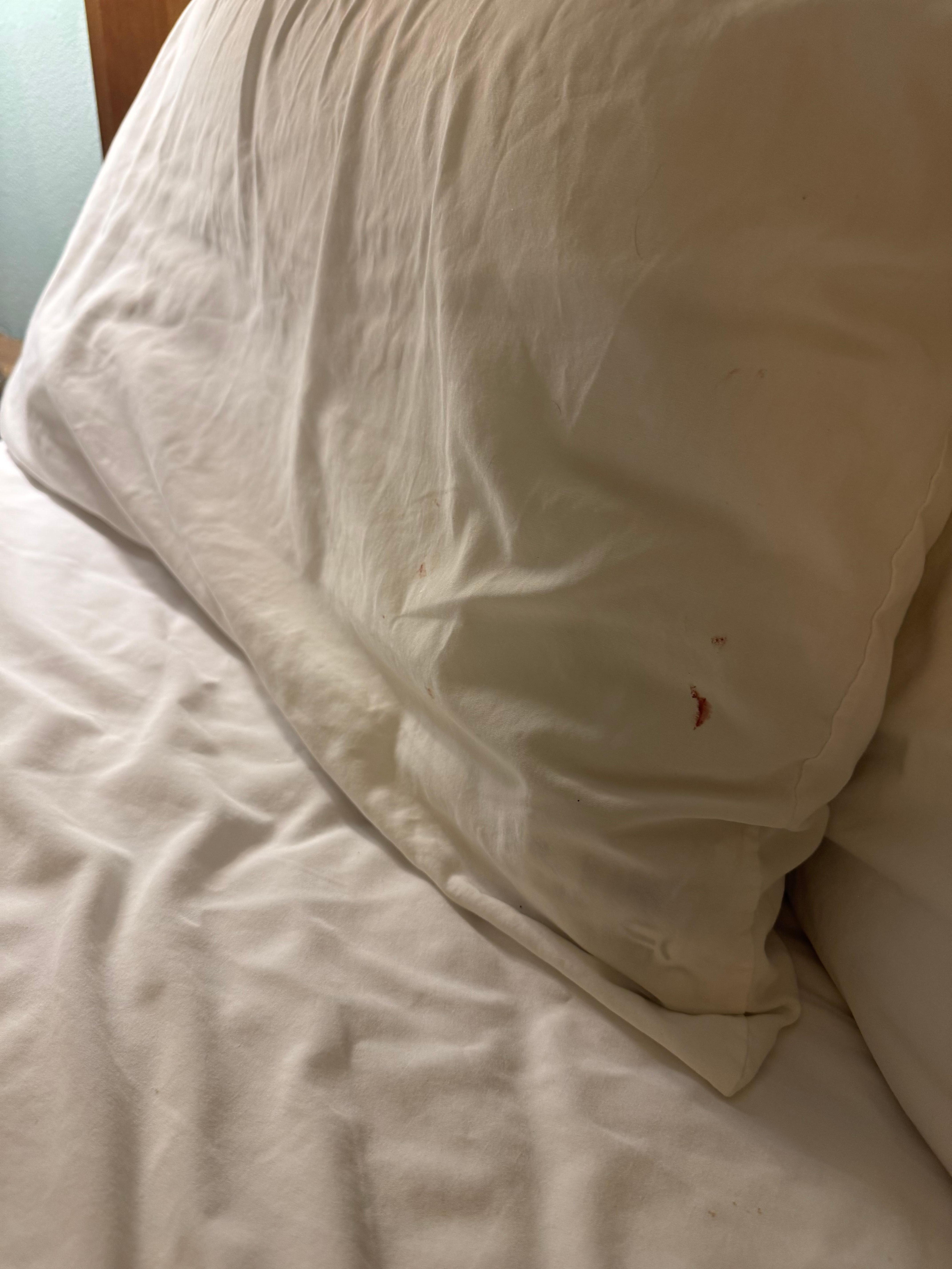 Pillow cases with what appeared to be blood stains. 